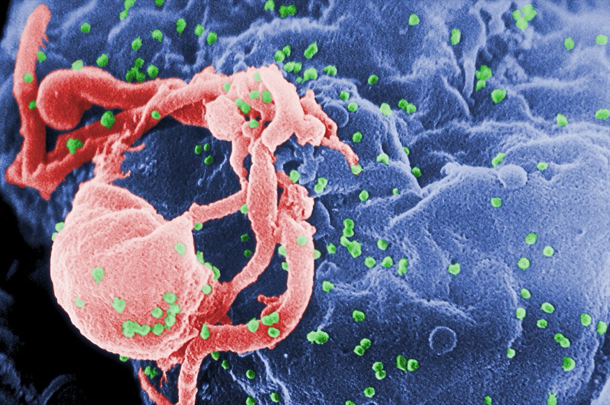 HIV가 림프구 표면에서 빠져나오는 모습을 찍은 전자현미경 사진